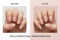 10 Weken Nagelbijten Traject – RK Nails - RK Nails & RK SieradenSieradengouden-sieraden-rvs-stainless-steel-Halskettingen-Armbanden-Oorbellen_ringen